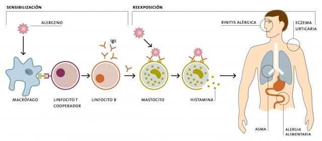 Alergia-mediada-IgE-alimentos